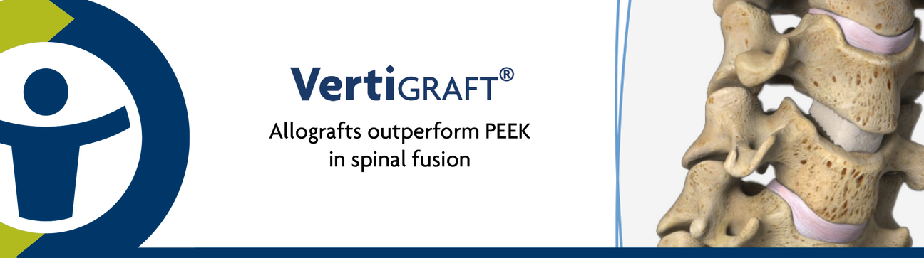 VertiGraft outperforms PEEK